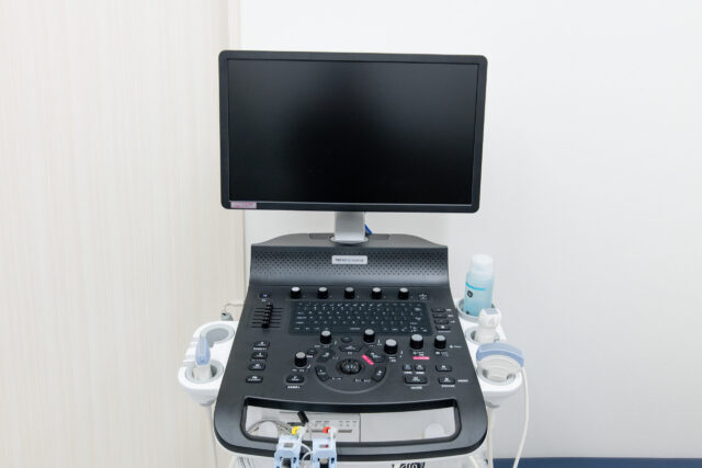 超音波診断装置